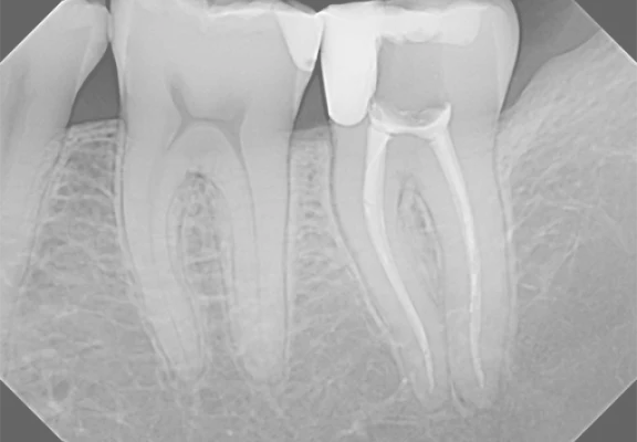NOMAD™ Pro 2 Handheld X-ray System | DEXIS